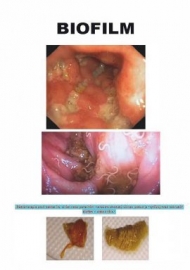 Biofilm a parazitární nákaza