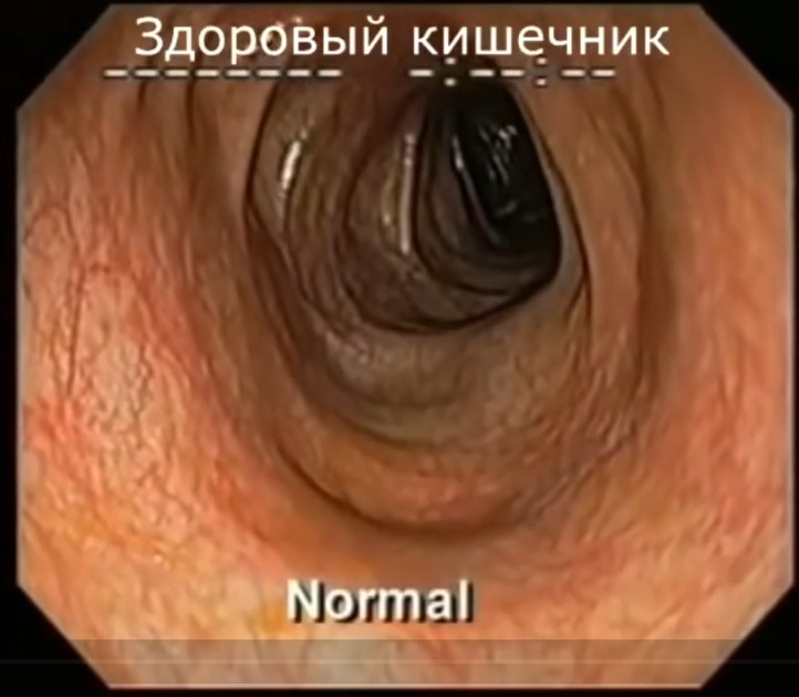 Náhled ruského videa – zdravé střevo